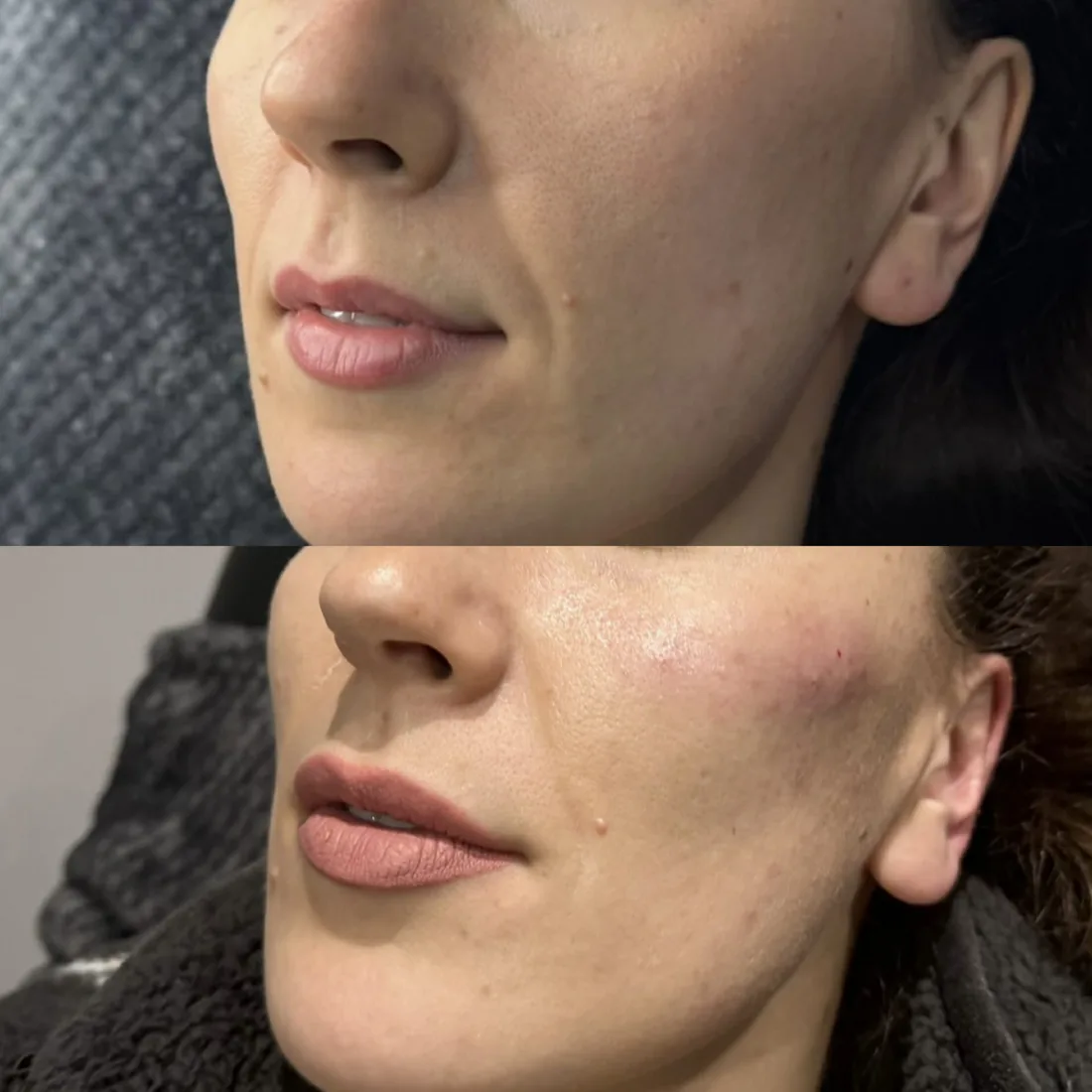 Client comparison photograph 09, published by Refined Medical Aesthetics with permission