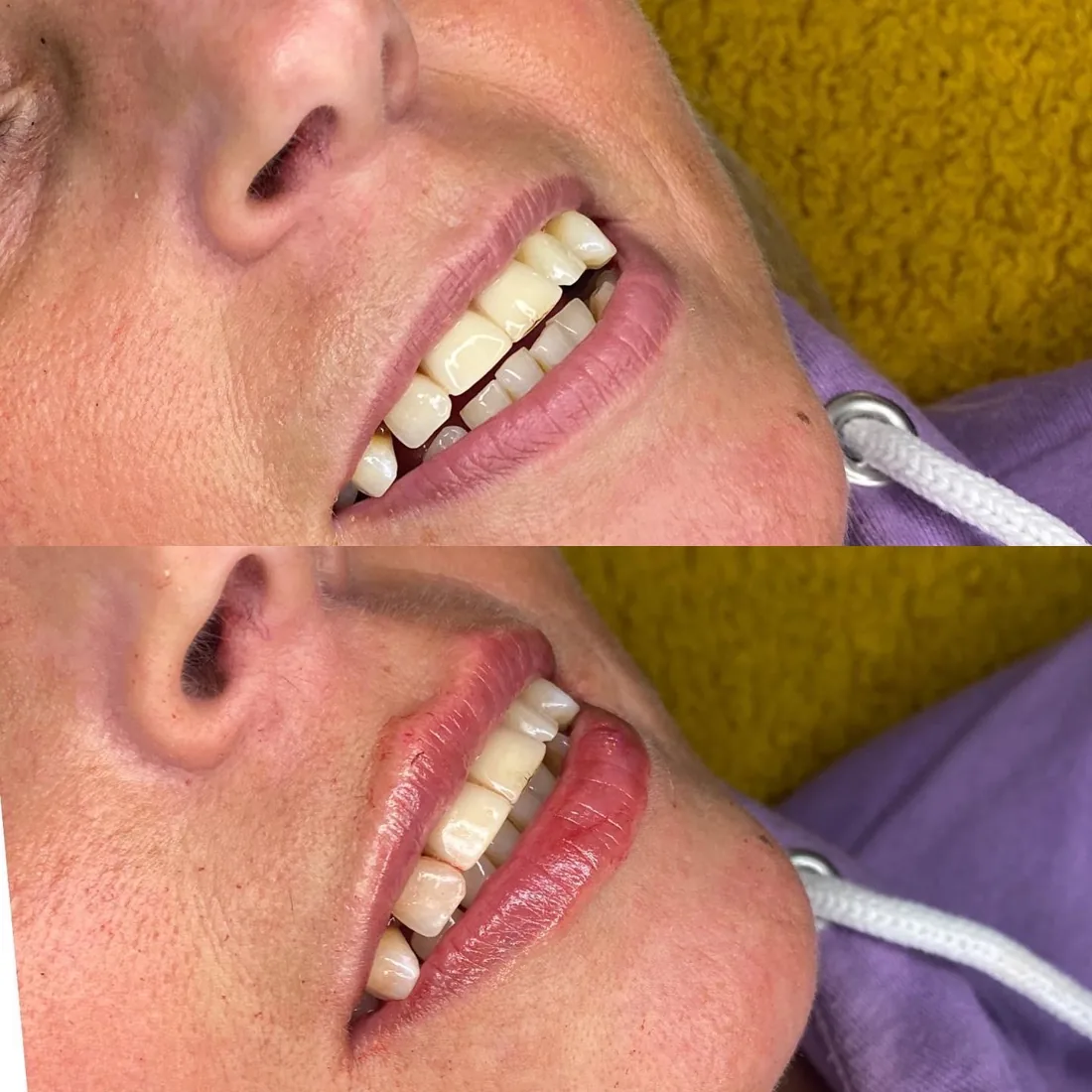 Client comparison photograph 17, published by Refined Medical Aesthetics with permission