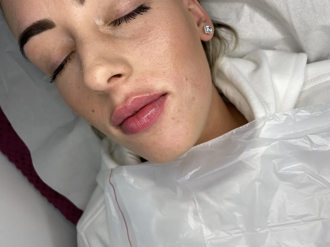 Client comparison photograph 23, published by Refined Medical Aesthetics with permission