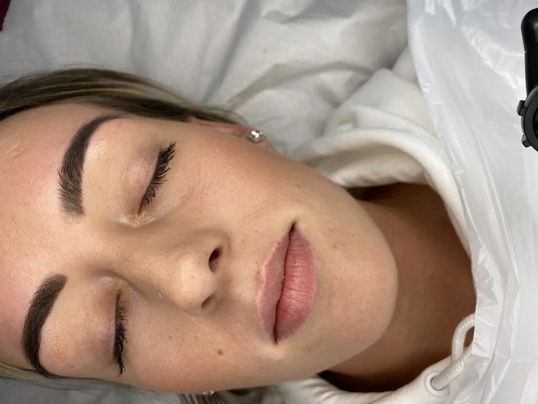 Client comparison photograph 25, published by Refined Medical Aesthetics with permission